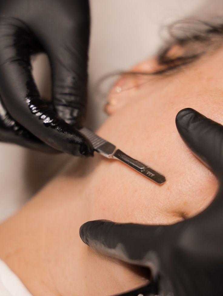 Dermaplaning - Dermalux LED Light Therapy