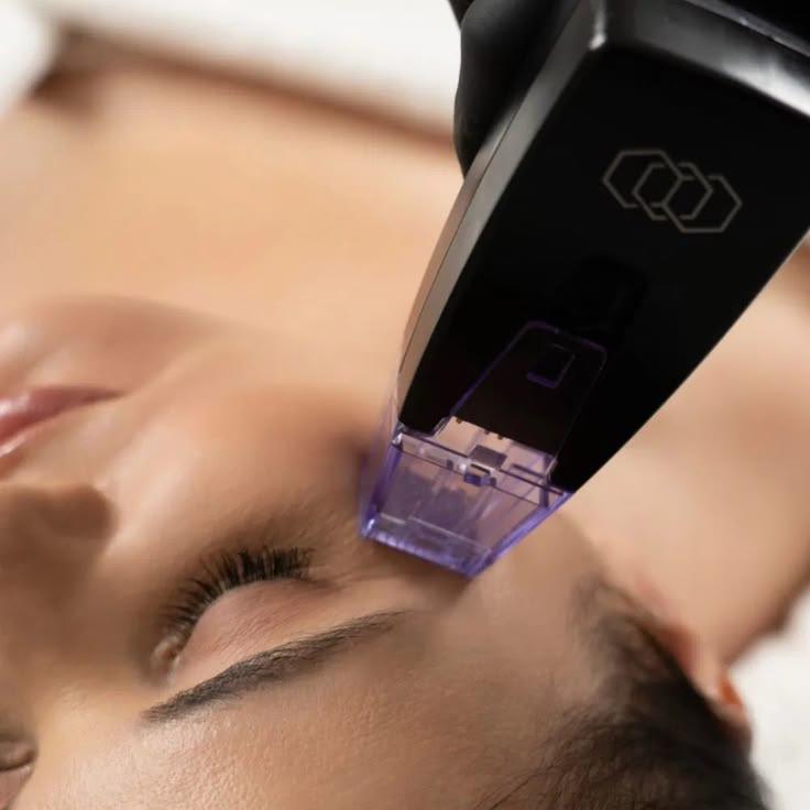 HIFU RF Microneedling